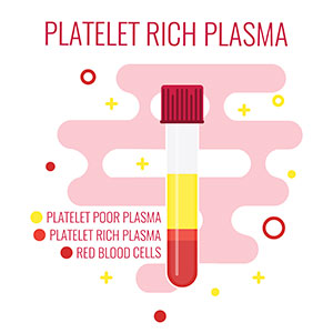 	platelet rich plasma, graft, oral surgery, gum tissue