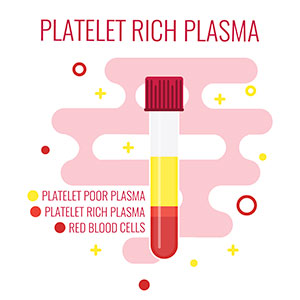 platelet rich plasma, graft, oral surgery, gum tissue